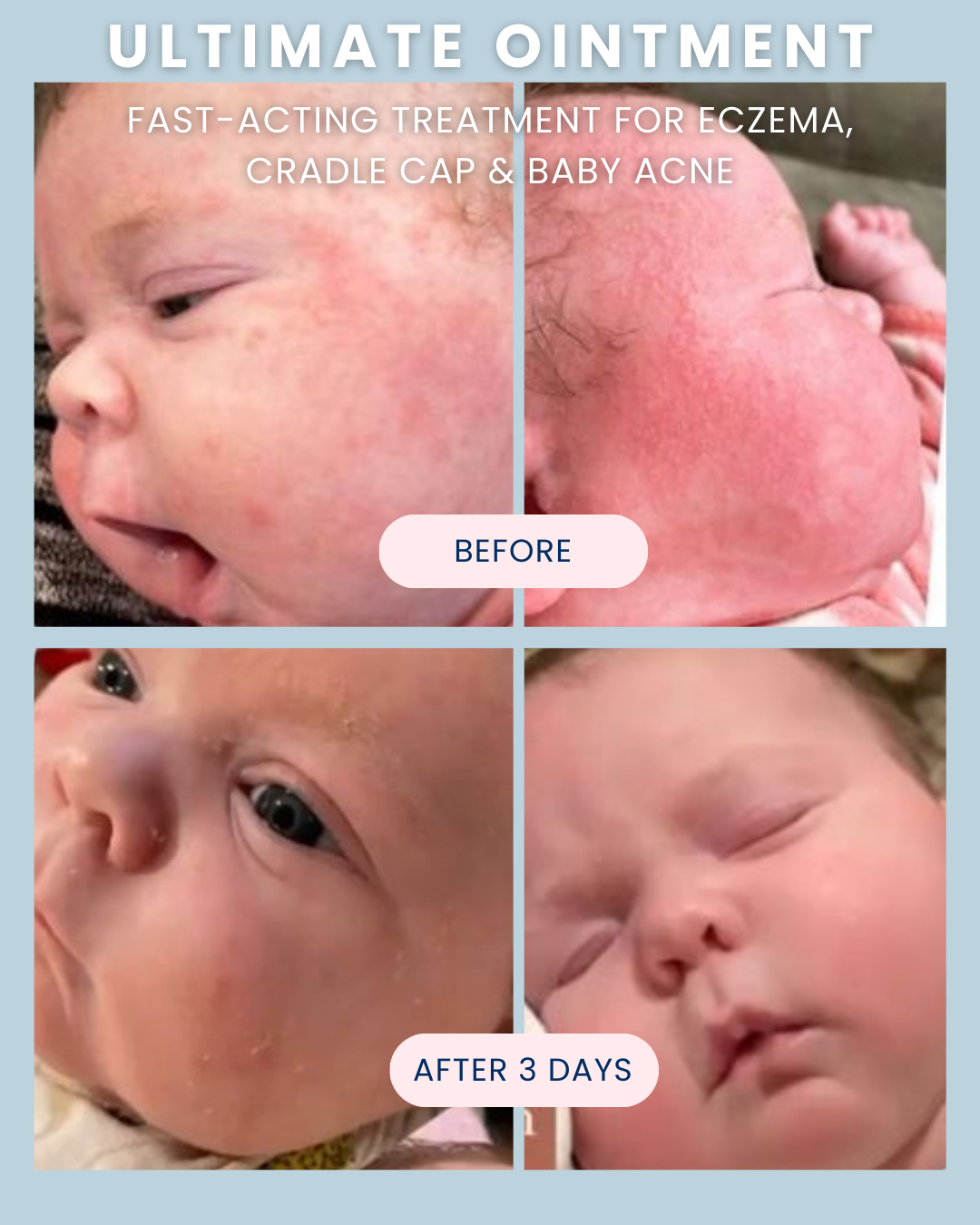 Ultimate Ointment, 3.4 oz